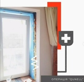 Пластическая операция откосов?